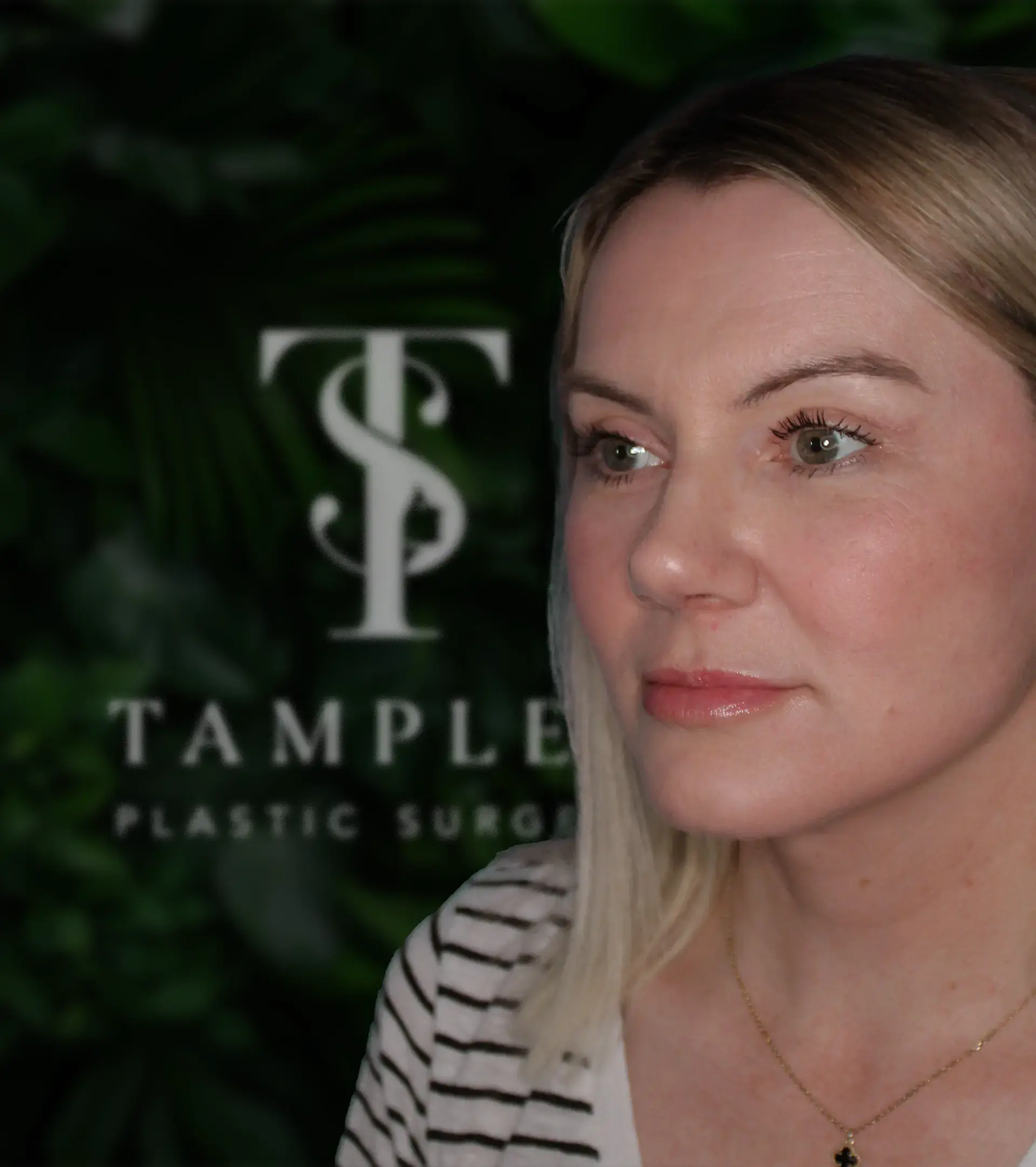 Tamplen Plastic Surgery Logo