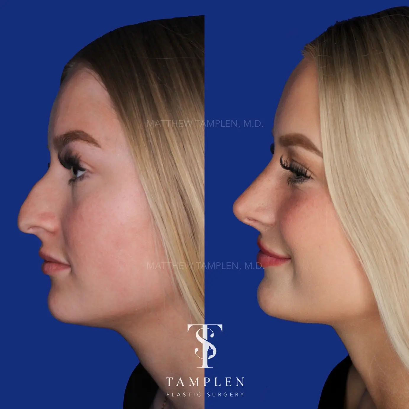 1. Straight and Natural