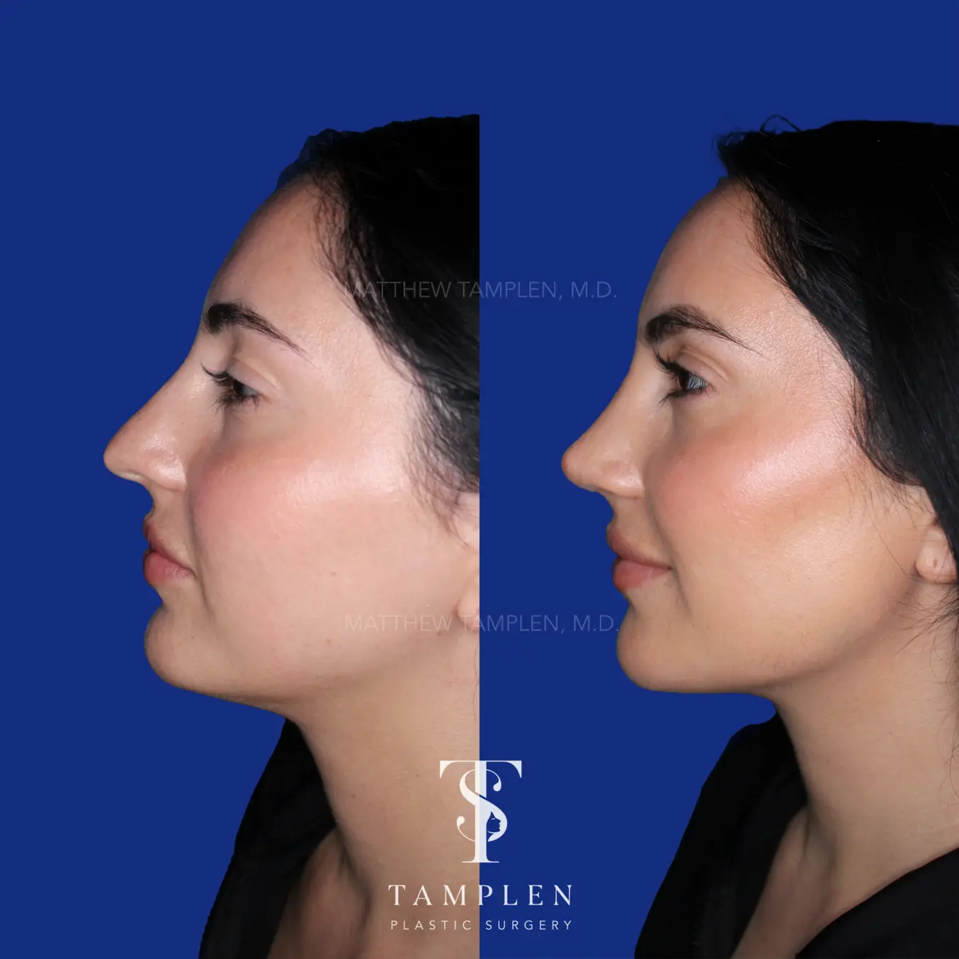 3. Somewhere in between